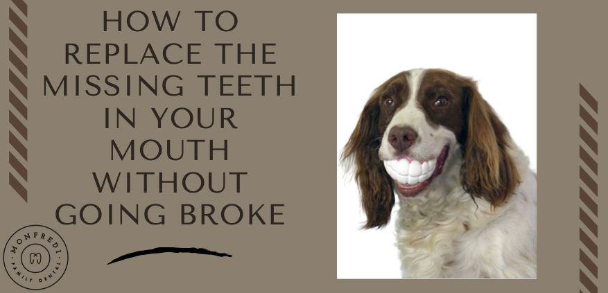 Replace-Missing-Teeth-Title-Photo
